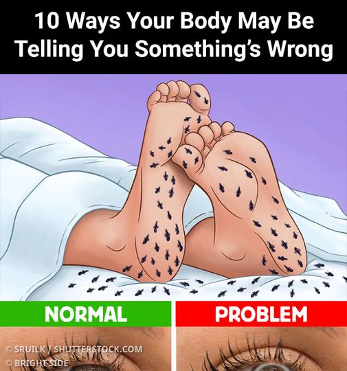 10 Ways Your Body May Be Telling You Something’s Wrong