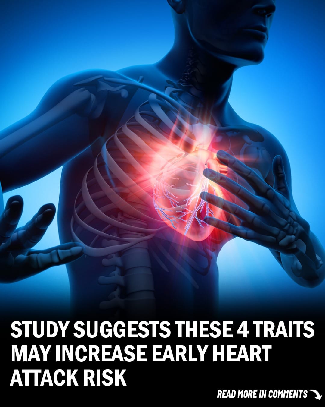 Study Suggests These 4 Traits May Increase Early Heart Attack Risk