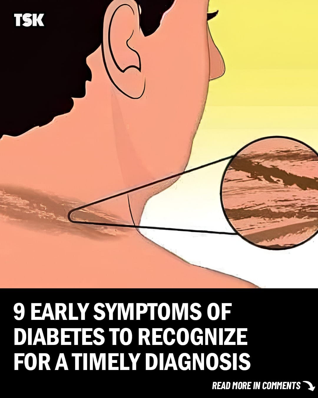 9 Early Symptoms of Diabetes to Recognize for a Timely Diagnosis