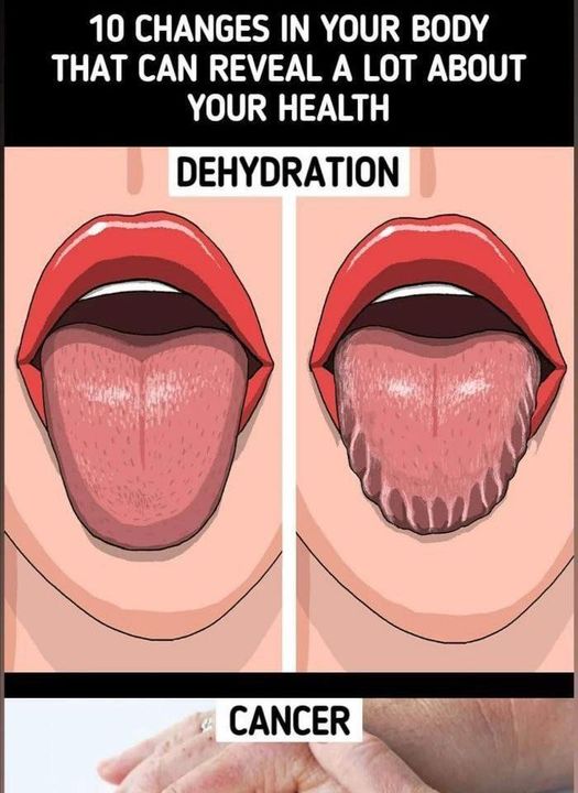 10 Symptoms That May Reveal Health Problems