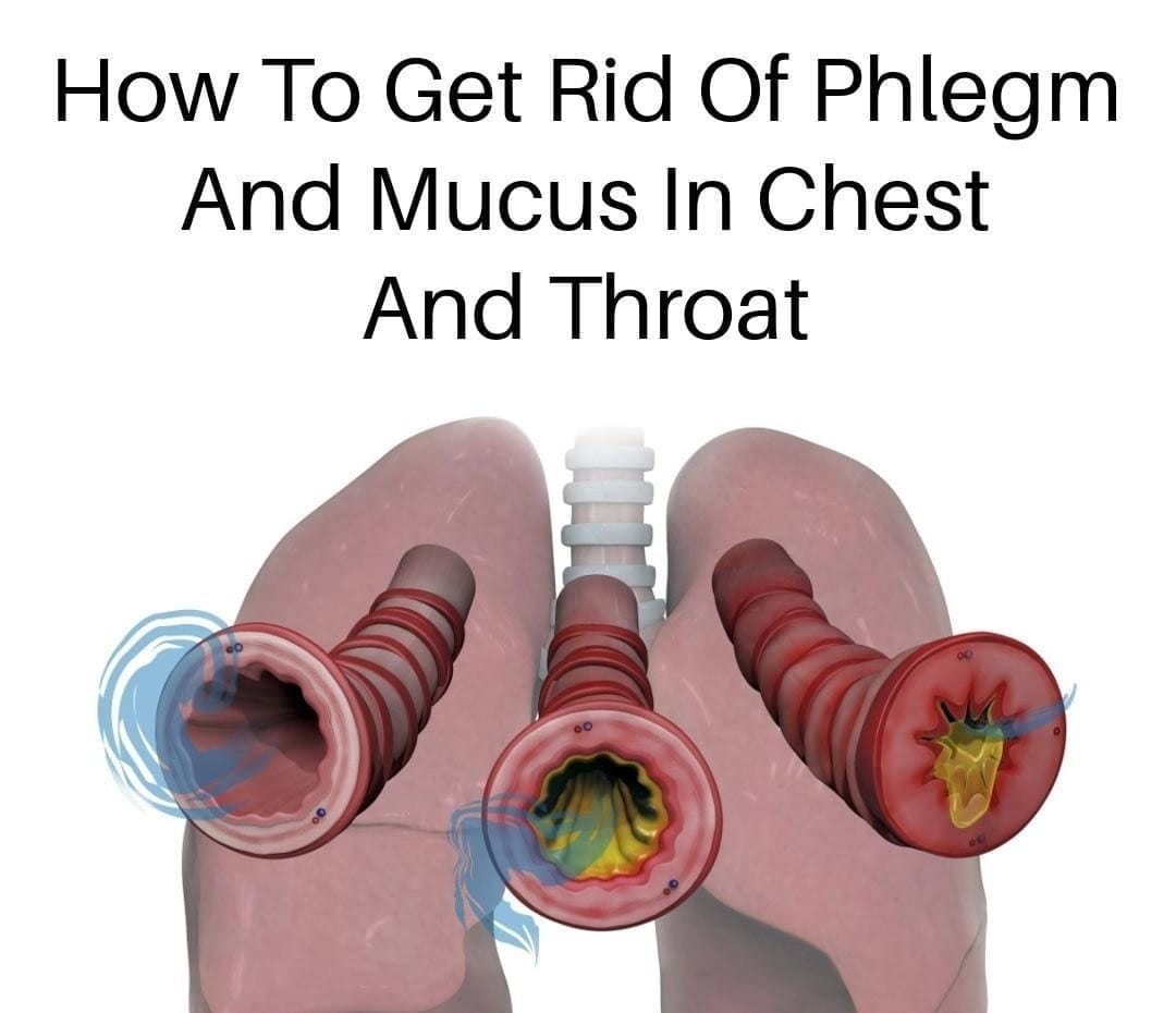 8 Ways To Get Rid Of Phlegm And Mucus In Chest And Throat