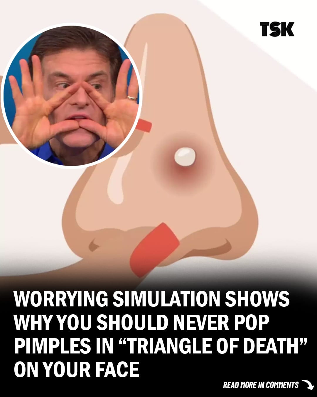 Scary Demonstration Shows Why You Should Never Pop Pimples In The ‘Triangle of Death’ On Your Face