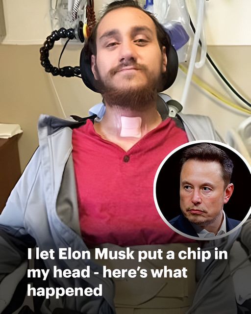 Man Who Let Elon Musk Put a Chip in His Head Says It ‘Changed His Life’