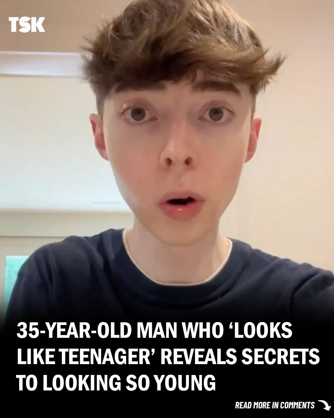 35-year-old Man ‘Who Looks Like a Teenager’ Reveals Secrets to Staying Young