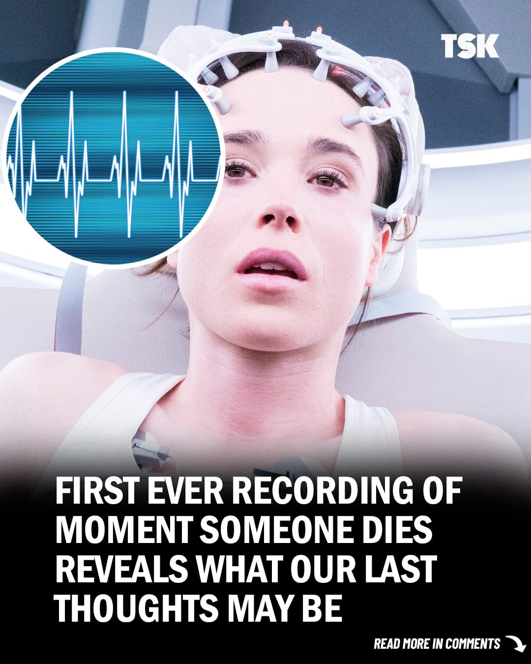 First Ever Recording Of Dying Human Brain Shows Possible “Life Recall” Activity