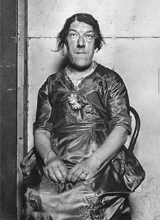 Mary Ann Bevan: The Tragic Story of the ‘World’s Ugliest Woman’
